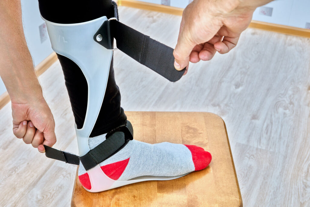 A person putting a brace on their leg and foot using orthopedic straps.